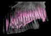 rotating maxilla with tooth battery