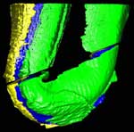 segmented specimen 1