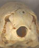Struthio skull - view of the occiput