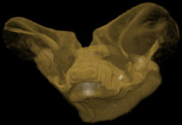 coronal cutaway