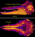 bone density